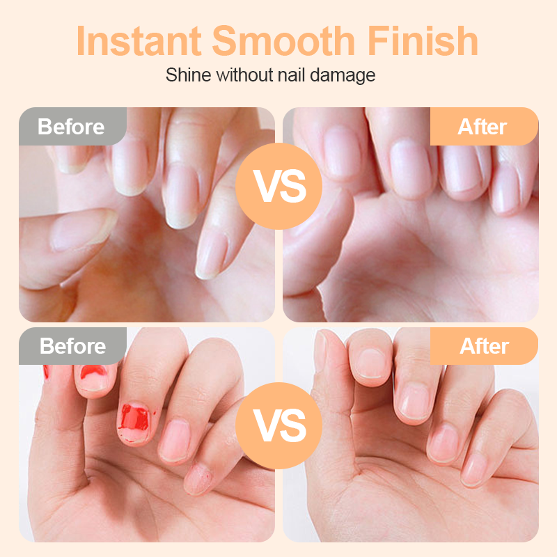 🔥 Last Day 70% OFF -🌟 2-in-1 Smart Electric Nail Clipper & Polisher ✂️💅